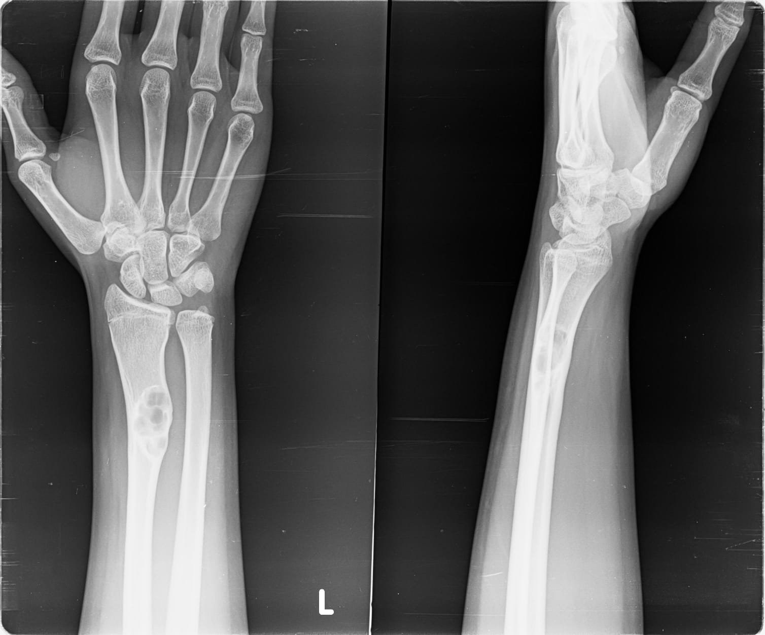 Benign Pediatric Lesions